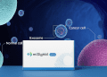 Home-based urine test kit with AI-driven microRNA cancer detection display